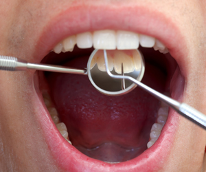 Close Up Dental Exam