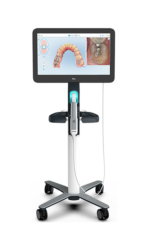 ITERO SCANNER — Valiente Dental