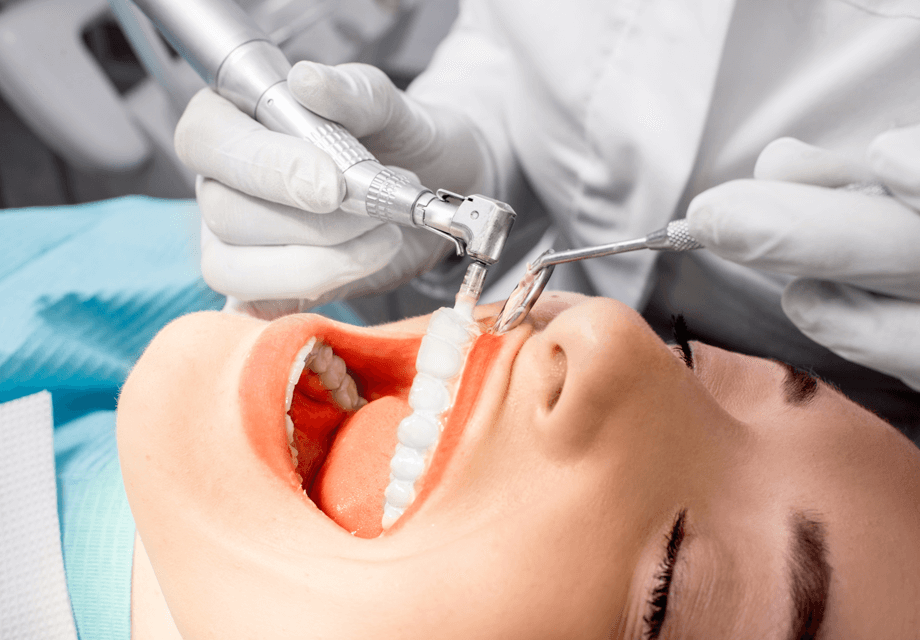 Teeth Cleaning Teeth Cleaning