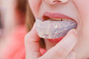 Woman with Mouthguard